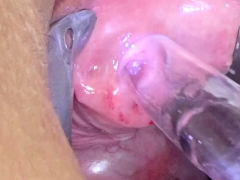 Woman Pee Hole Playing Urethral Insertion with Endoscope Cam