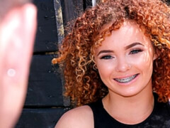 Beautiful Blinding Braces