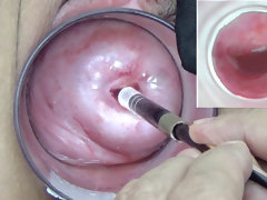 Mature Wife Cervix Playing with Endoscope Japanese Cam into Uterus