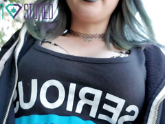 Zichtbare schaamlippen