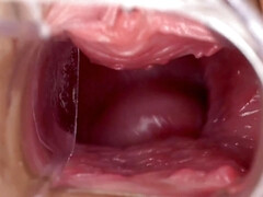 Европейки, Гинеколог, Мастурбация, Киски, Соло, Молоденькие, Игрушки